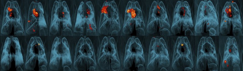 Estudio: Vacuna contra tuberculosis es mejor intravenosa